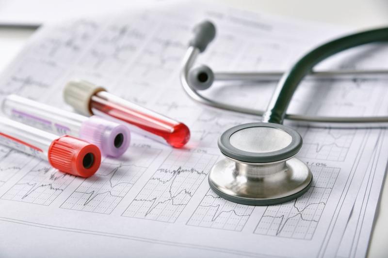 Koszty i czas oczekiwania badań po utracie uprawnień